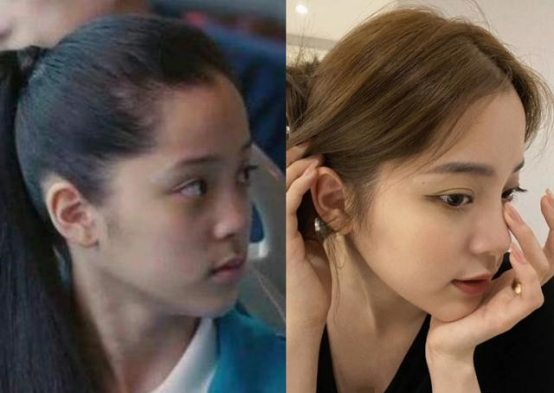 被讽刺多年的塌鼻子,欧阳娜娜在生日这天,还是把它给办了?