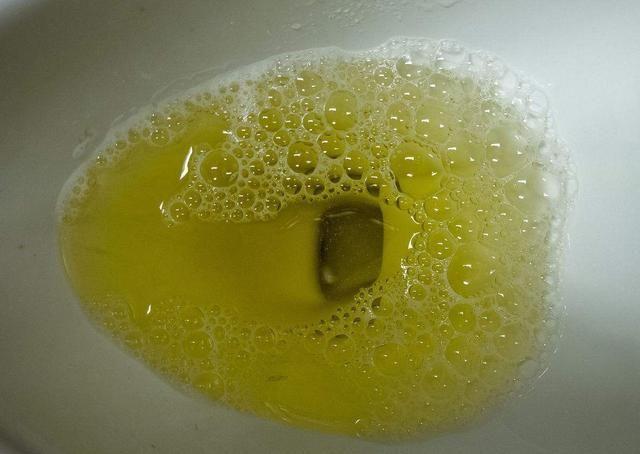 晨尿|若“晨尿”没有这4种表现，多半说明肾脏挺好，值得庆贺