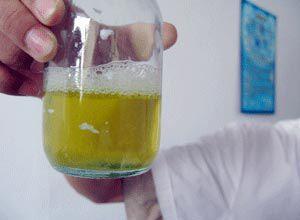 晨尿|若“晨尿”没有这4种表现，多半说明肾脏挺好，值得庆贺