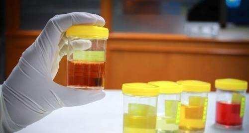 晨尿|若“晨尿”没有这4种表现，多半说明肾脏挺好，值得庆贺