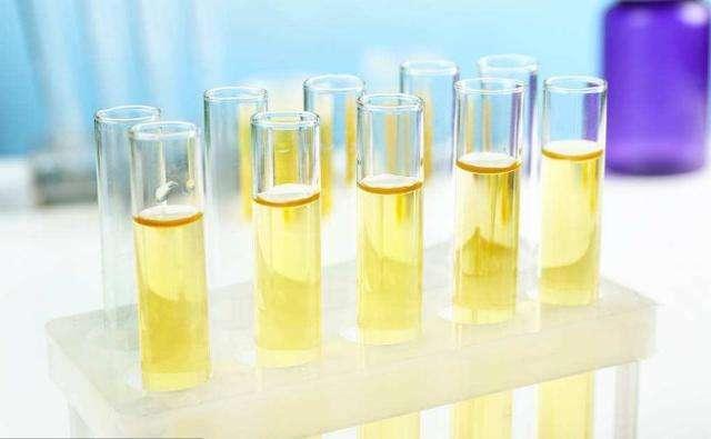 晨尿|若“晨尿”没有这4种表现，多半说明肾脏挺好，值得庆贺