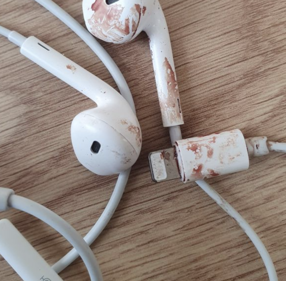 马路|英国16岁少年戴耳机过马路被撞成重伤，脑袋被撞个大洞奇迹生还