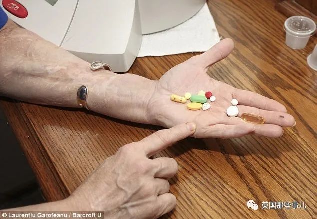 美国_社会|美国首例换脸人去世：丈夫之前家暴是种预示，不该心怀侥幸