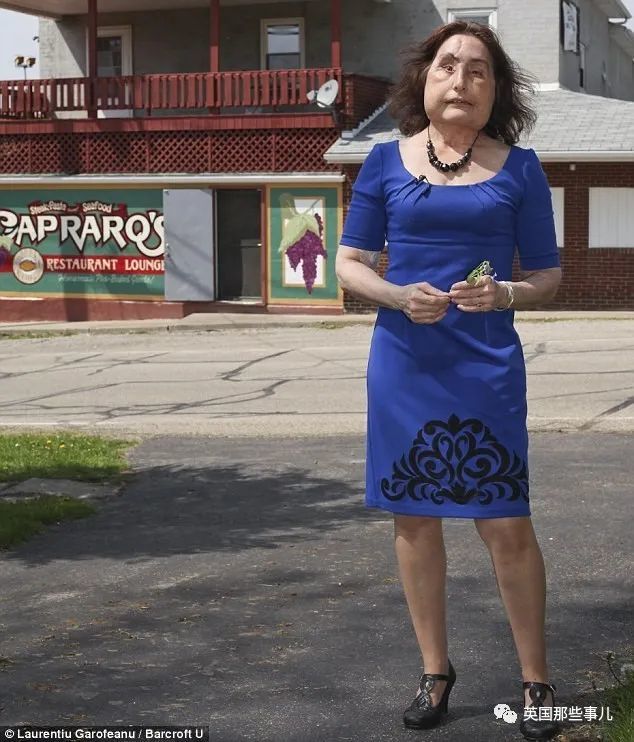 美国_社会|美国首例换脸人去世：丈夫之前家暴是种预示，不该心怀侥幸