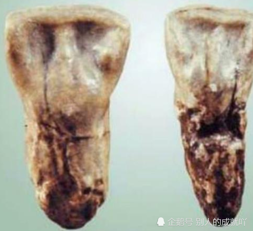 印记|祖先留在中国人身上三大印记，每个炎黄子孙都有，看看你有吗？