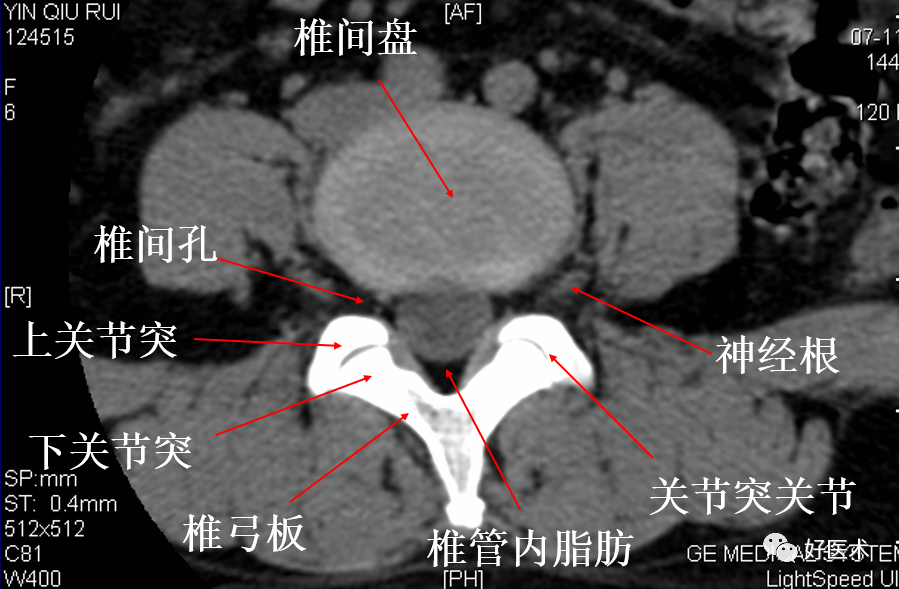 在ct或mri橫斷