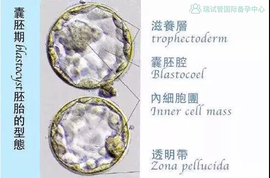 瑞试管微科普 3分钟学会试管胚胎报告的正确解读方式 腾讯新闻