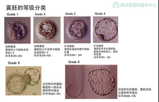 瑞试管微科普 3分钟学会试管胚胎报告的正确解读方式 腾讯新闻