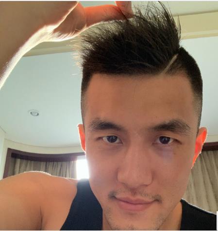 郭艾伦晒新发型求证医生是否脱发球迷下次找个专门治脸皮厚的