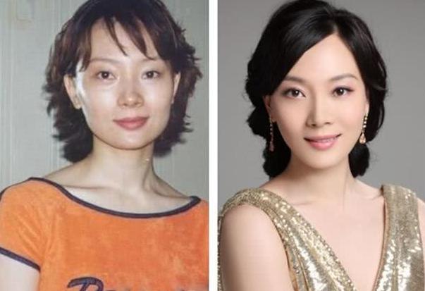 整容|打死也不信他们没有整容，都不知道动了多少刀，根本就变了一个人