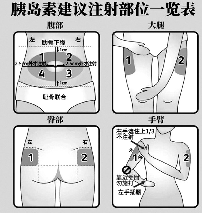 利拉鲁肽注射位置图片图片