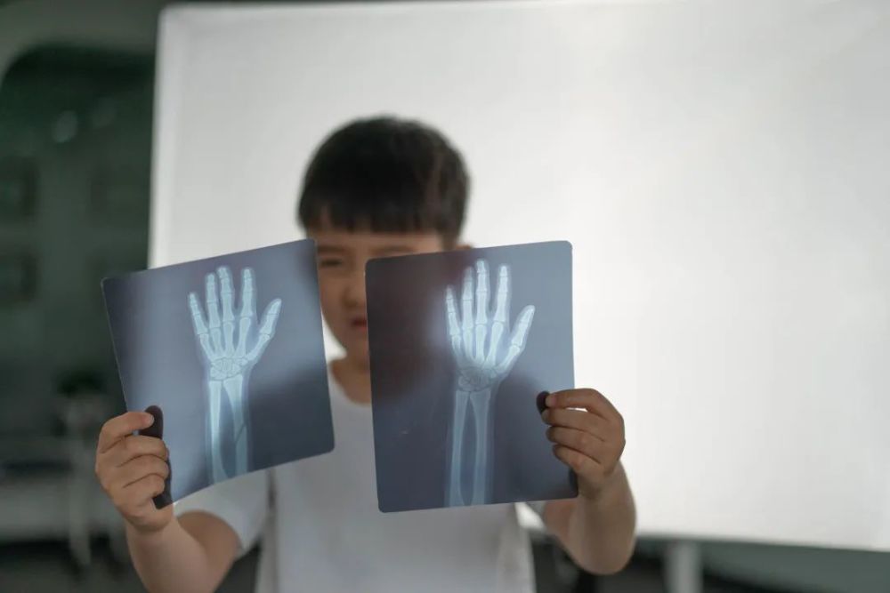 孩子|拍X光片、手术缝合、自制血液循环……娃竟然玩了俩小时没理我！