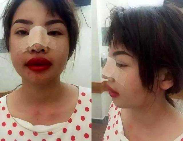 那个为嫁进豪门花10万整容的越南凤姐嫁给当地富豪现状如何