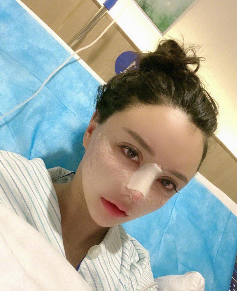 韩安冉|韩安冉五年间35次整容成瘾，如今尖鼻似假人，21岁的她还能收手吗