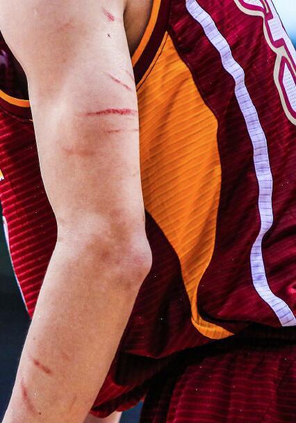 吴前48分创本土新纪录 胳膊遍布血道子让人心疼