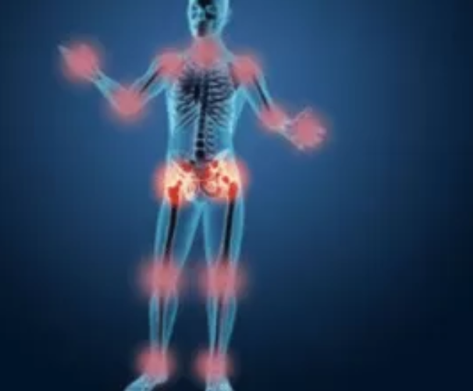 类风湿关节炎|教你一种不花钱预防类风湿的办法！