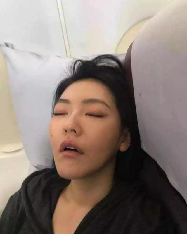 张嘴睡觉越来越丑