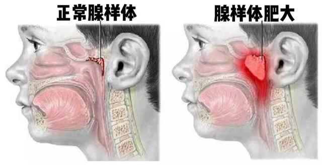 张嘴睡觉 越来越丑 腾讯新闻