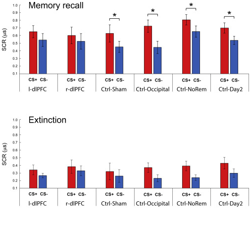 强迫症|强迫症有救了！科学家证实：非侵入性磁刺激可消除负面记忆