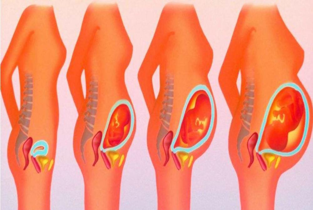 孕期水肿惹人烦国际级瘦身教练来支招送给孕妈瘦身小秘籍