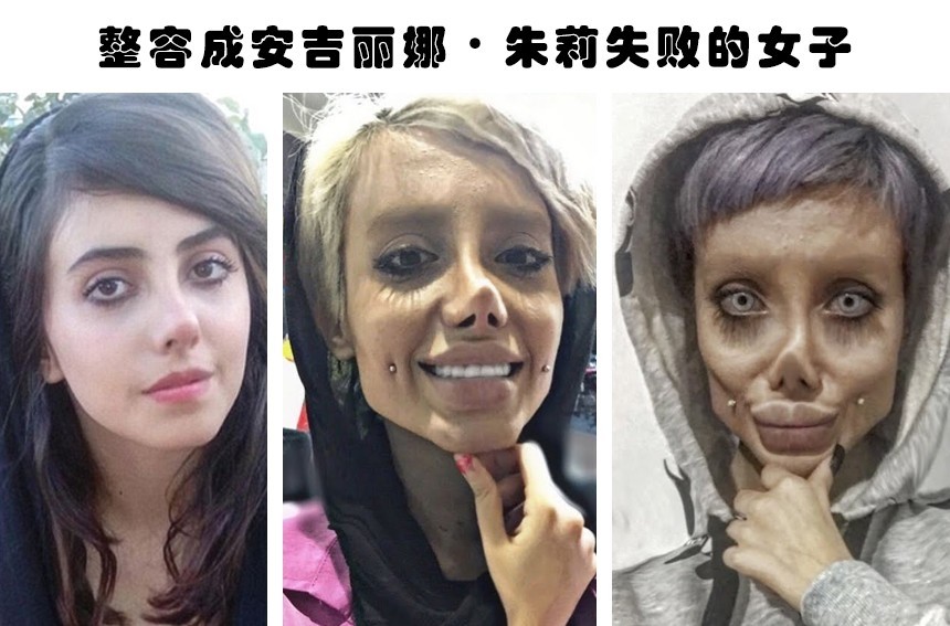 整容失败的代价据说因为整容而毁掉了自己容貌的6个人