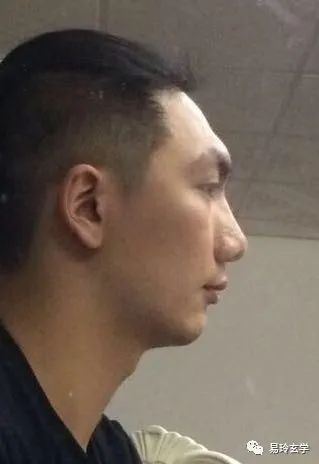 眉骨带 金凸 的吉凶 眉毛 面相