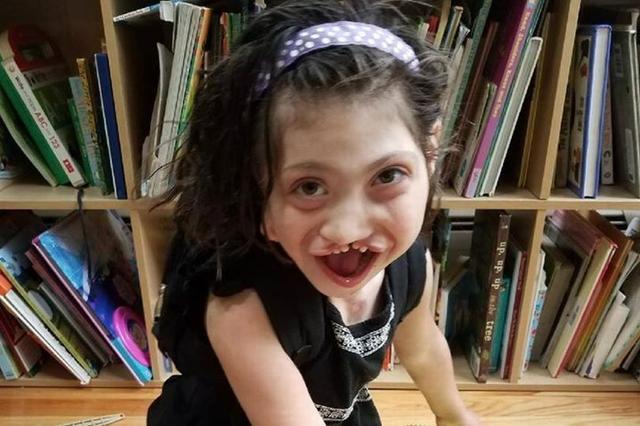 美国代孕母亲坚持生下畸形儿女孩在收养家庭幸福生活8年去世