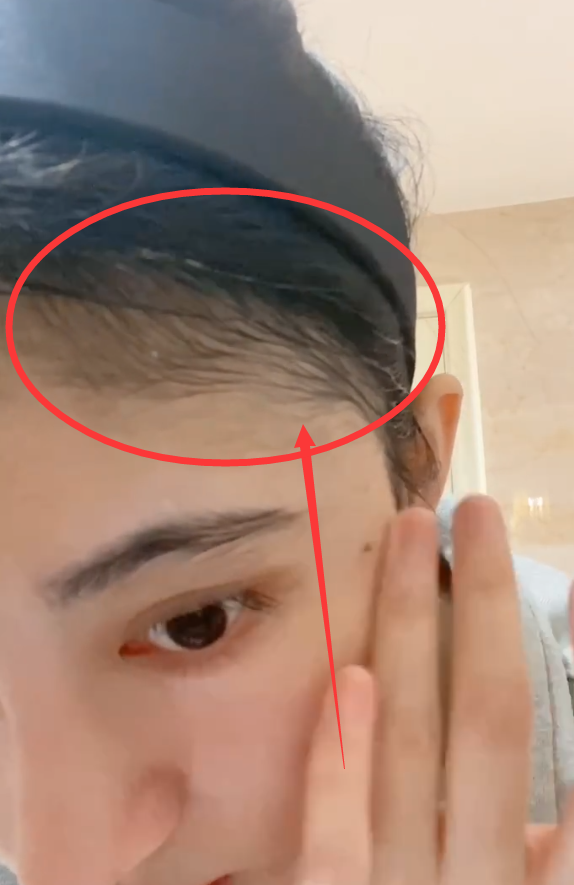 有一种发量过剩叫鞠婧祎,别人发际线在脑门,她都长到脸上去了!