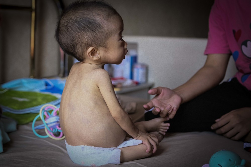 广东一岁男婴"肚大如球"急赴千里之外求医,医院给的结果太吓人