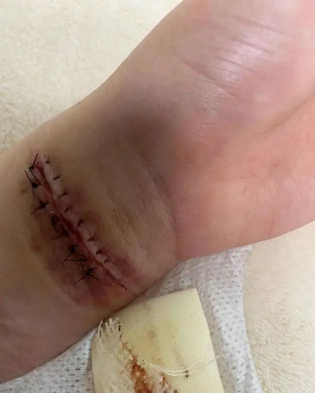 曾志伟太太朱锡珍病逝;aoa权珉娥再次割腕自杀;长春电影