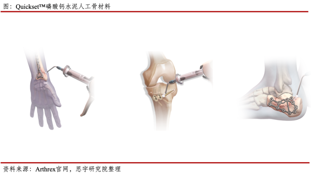 医学教育資料・臨床資料・研究材料　人工膝関節（TKA） 医学教育資料・臨床資料・研究材料 人工膝関節（TKA）