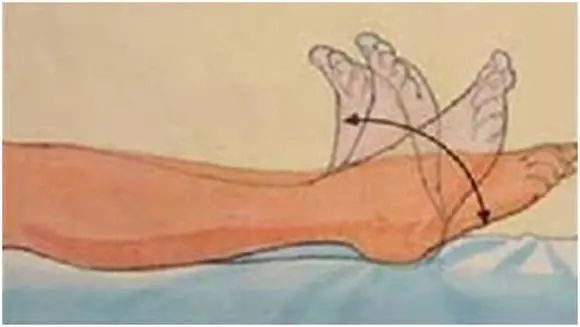 脑梗塞|为什么越来越多的人得脑梗？三件事是“祸根”，劝你别做