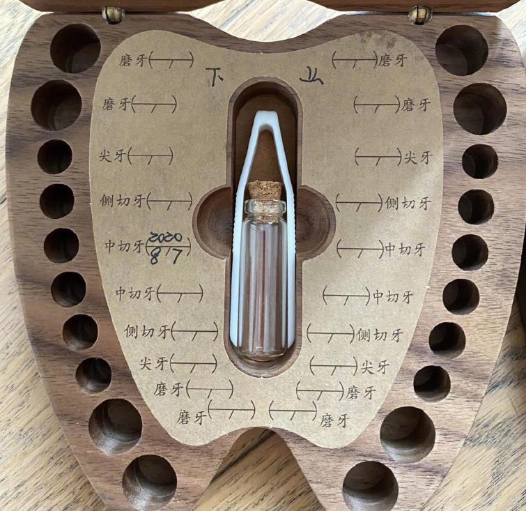 小花妹妹|孙俪好有仪式感，小花妹妹掉人生第一颗乳牙，她用特制礼盒收藏