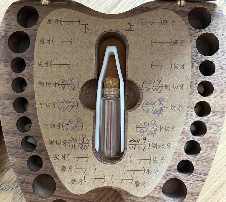 小花妹妹|孙俪好有仪式感，小花妹妹掉人生第一颗乳牙，她用特制礼盒收藏