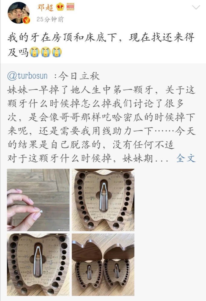 孙俪|邓超羡慕女儿的装牙宝盒，喊话想找回自己的乳牙，网友：直接拔一颗