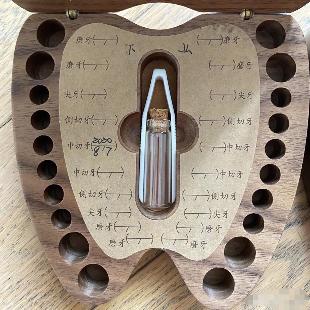 孙俪|邓超羡慕女儿的装牙宝盒，喊话想找回自己的乳牙，网友：直接拔一颗