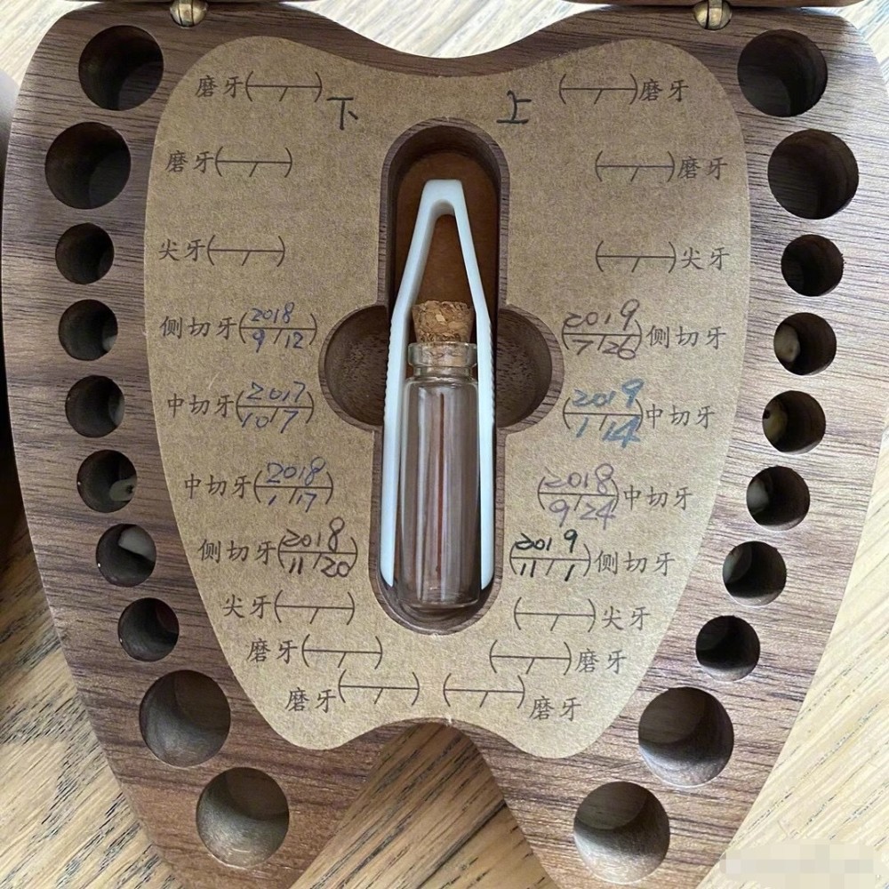 孙俪|邓超羡慕女儿的装牙宝盒，喊话想找回自己的乳牙，网友：直接拔一颗