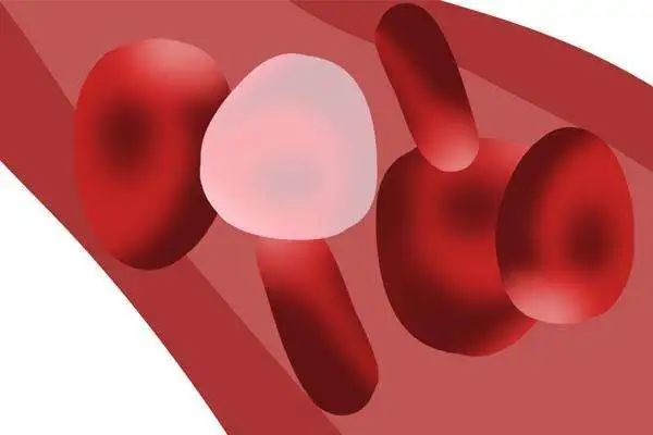 高血脂|夏季高血脂患者要注意，这些误区要避免！