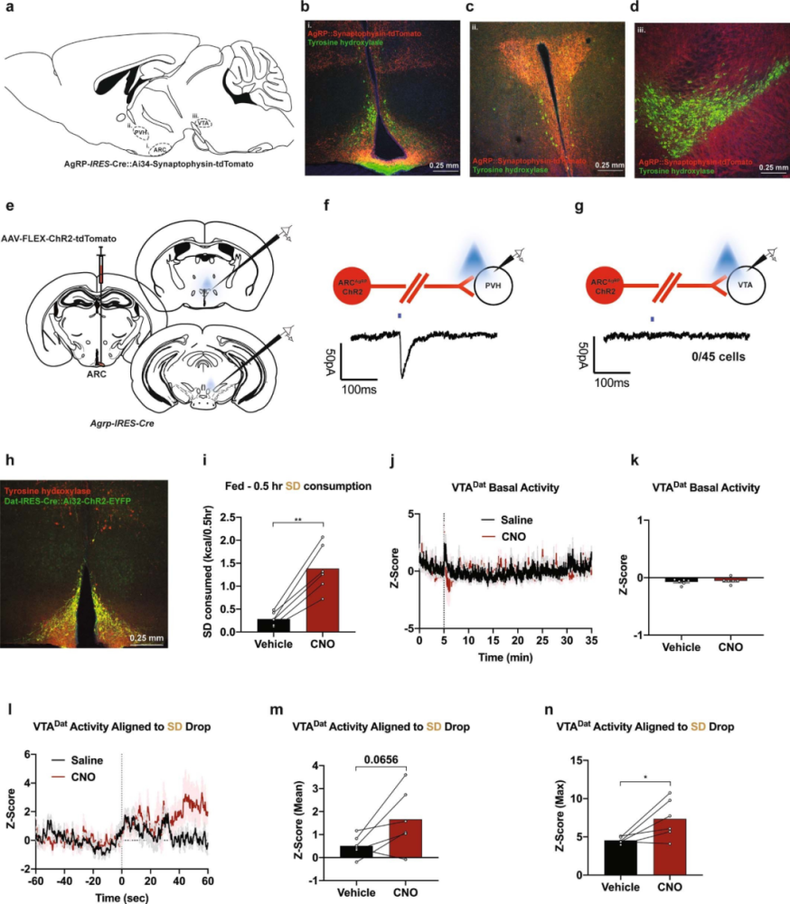 睡眠|脑科学日报：为什么胖人通过节食减肥很困难？充足睡眠改善记忆力