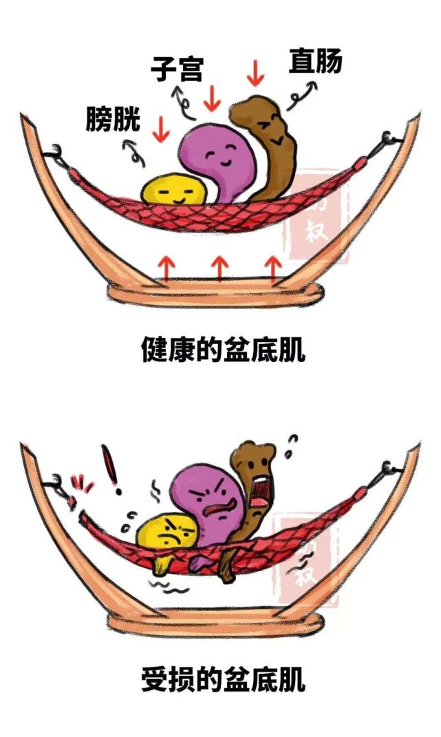 事关身体健康和生活质量"吊床"的功能好不好托住生殖和泌尿系统