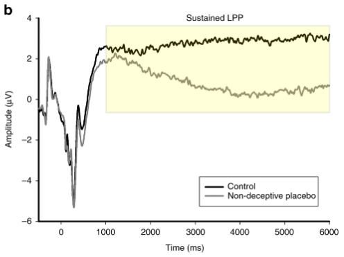 节细胞神经瘤|脑科学日报：大脑谋划作弊背后的神经机制；安慰剂效应有多强？