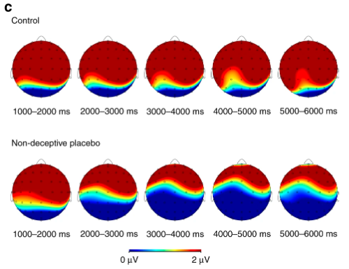 节细胞神经瘤|脑科学日报：大脑谋划作弊背后的神经机制；安慰剂效应有多强？