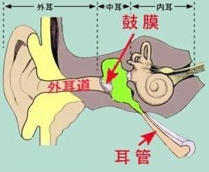 鼓膜穿孔有多严重 生活中注意这些保护好鼓膜 腾讯新闻