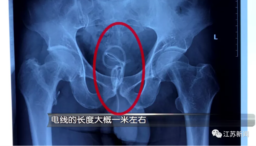  把珠子凶狠推入 把珠子一颗一颗推入用力拉出,大巴车他要了我