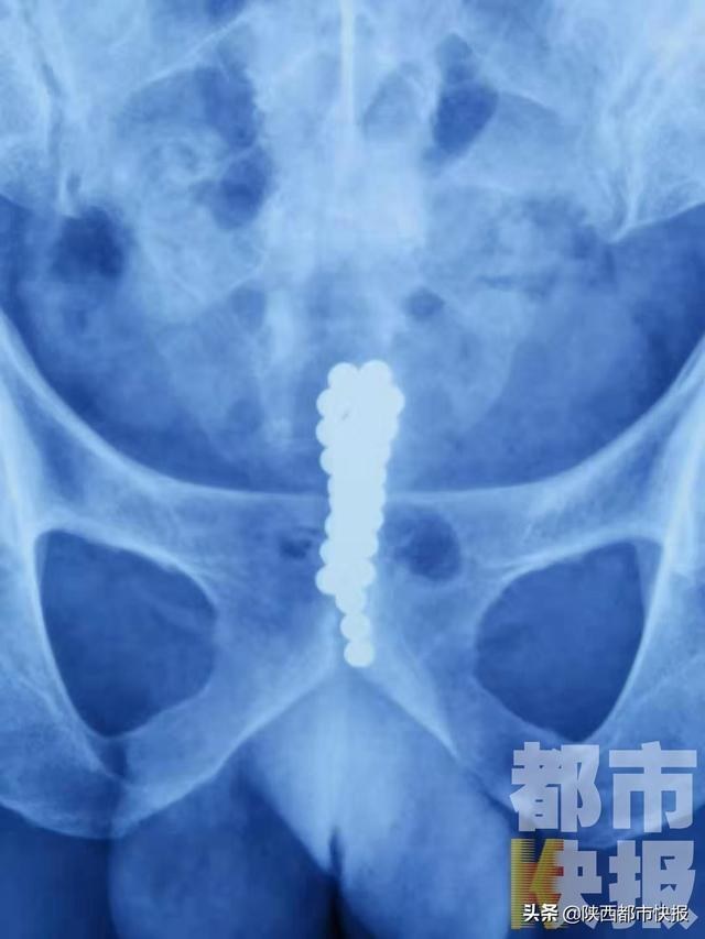  把珠子凶狠推入 把珠子一颗一颗推入用力拉出,大巴车他要了我