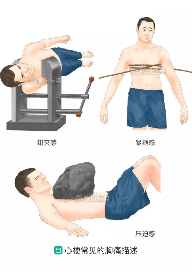 心肌梗塞|心梗来袭，急诊医生告诉你哪些能救命，哪些会要命！