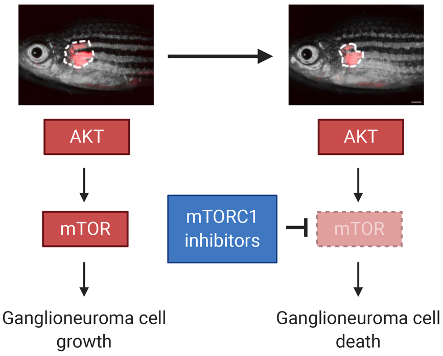 节细胞神经瘤|脑科学日报：大脑谋划作弊背后的神经机制；安慰剂效应有多强？