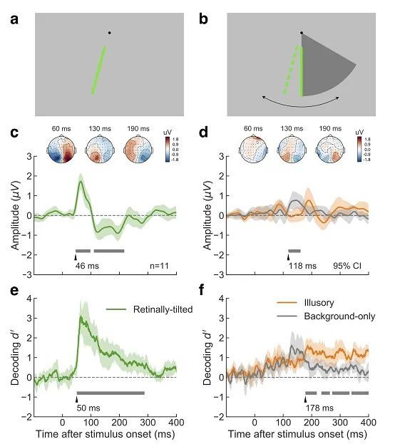 节细胞神经瘤|脑科学日报：大脑谋划作弊背后的神经机制；安慰剂效应有多强？