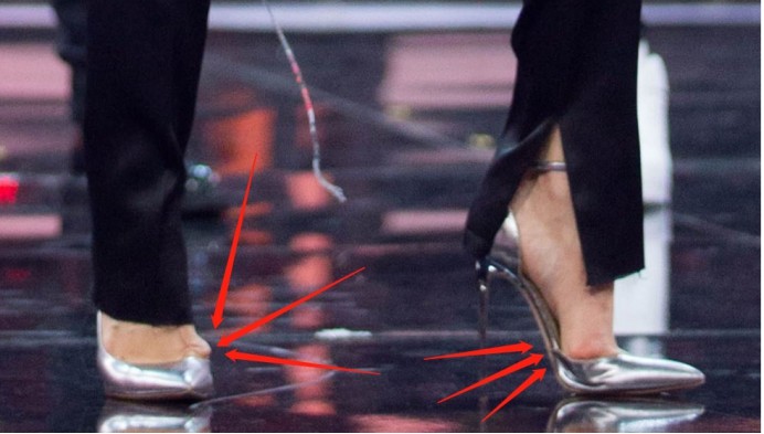 宋茜的脚有多"可怕"?脚趾外翻扭曲变形,网友:爱美的代价!