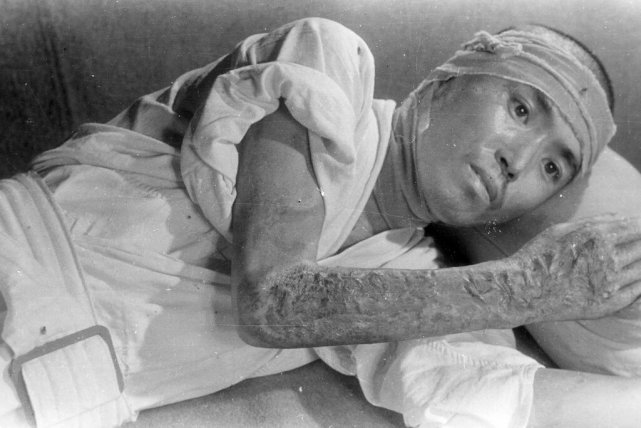 广岛辐射后的 女人图片